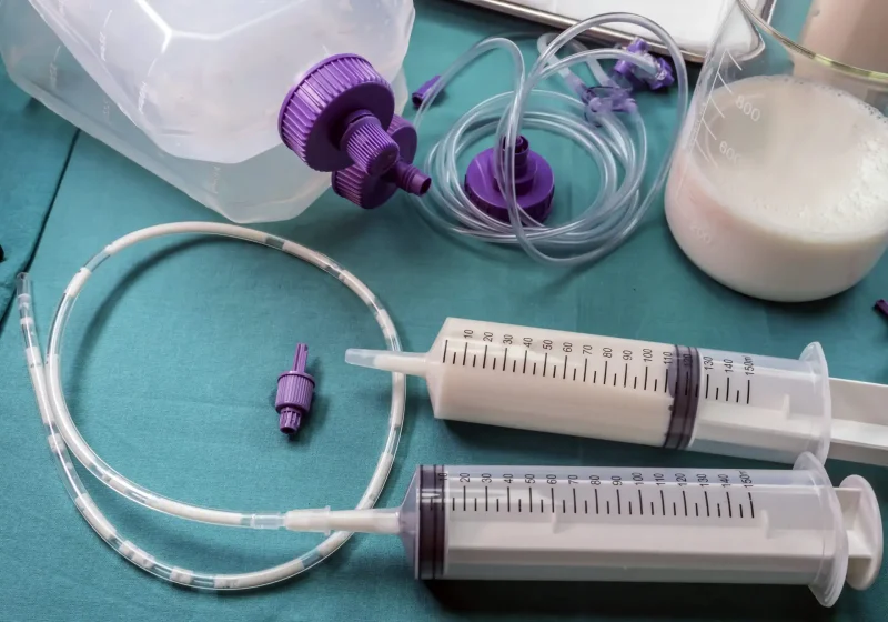 Une sonde pour la nutrition entérale avec les explication de l'HAD 35